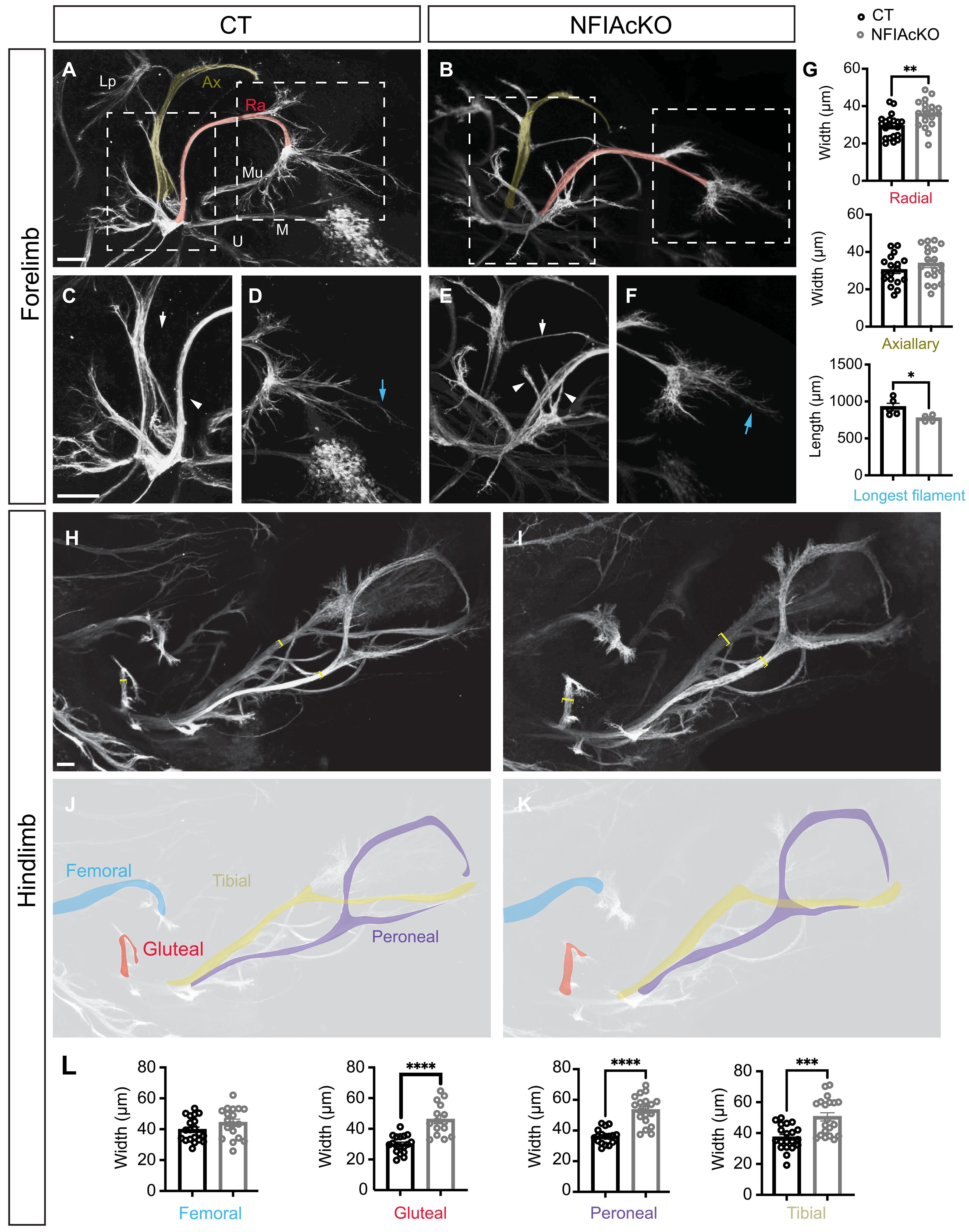 Spinal motor neuron development and metabolism are transcriptionally regulated by nuclear factor IA