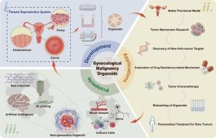 Gynecological malignancy organoids: A game changer for personalized medicine