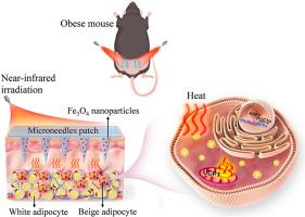 Microneedles-based local photothermal therapy promotes browning of white adipose tissue and combats obesity