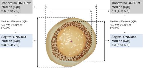 Optic Nerve Sheath Diameter: Which Axis Should Be Measured?