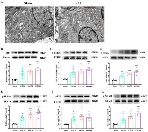 Correction to “Protein Tyrosine Phosphatase 1B Contributes to Neuropathic Pain by Aggravating NF-κB and Glial Cells Activation-Mediated Neuroinflammation via Promoting Endoplasmic Reticulum Stress”
