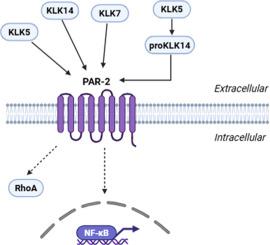 KLK5 and KLK7 drive cervical carcinoma via KLK14-dependent RhoA and NF-κB pathways