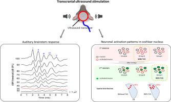 The impact of transcranial ultrasound on auditory brainstem responses and neuronal activation in the cochlear nucleus