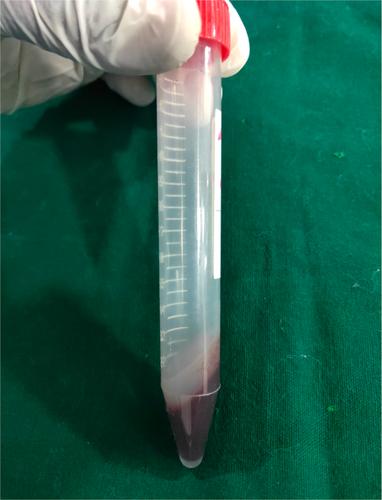 Evaluation of 3D-Printed Polylactic Acid as a Bone Substitute: An Animal Study in a Rat Model