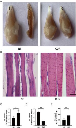 Curcumin Promotes the Recovery of Motor Function After Brachial Plexus Avulsion Injury in Rats