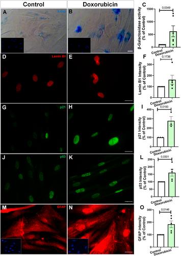 Doxorubicin Induces a Senescent Phenotype in Murine and Human Astrocytes
