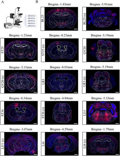 Study on the Central Neural Pathways Connecting the Brain and Peripheral Acupoints Using Neural Tracers