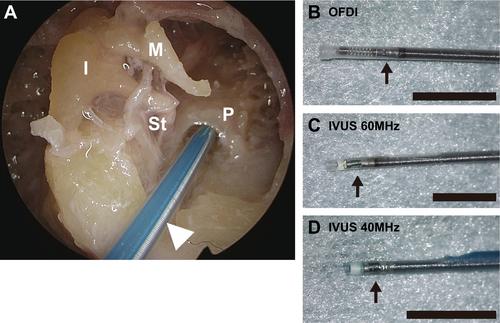 Intracochlear Imaging Using IVUS and OFDI: A Cadaveric Feasibility Study