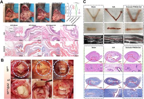 From Bench to Bedside: Hydrogel Platforms Bridging Anti-Adhesion Barriers, Tissue Regeneration, and Personalized Postoperative Recovery