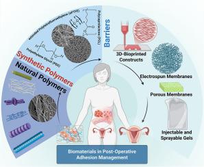 Gynecologic postoperative anti-adhesion barriers: From biomaterials to barrier development