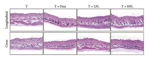 2′-Fucosyllactose Alleviates Hair Loss in Testosterone-Induced Androgenic Alopecia Mice