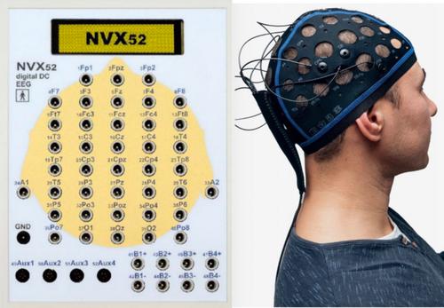 Effects of Obstructive Sleep Apnea on Cognition: An Analysis of Electroencephalography Microstates and Alpha Peak Frequency