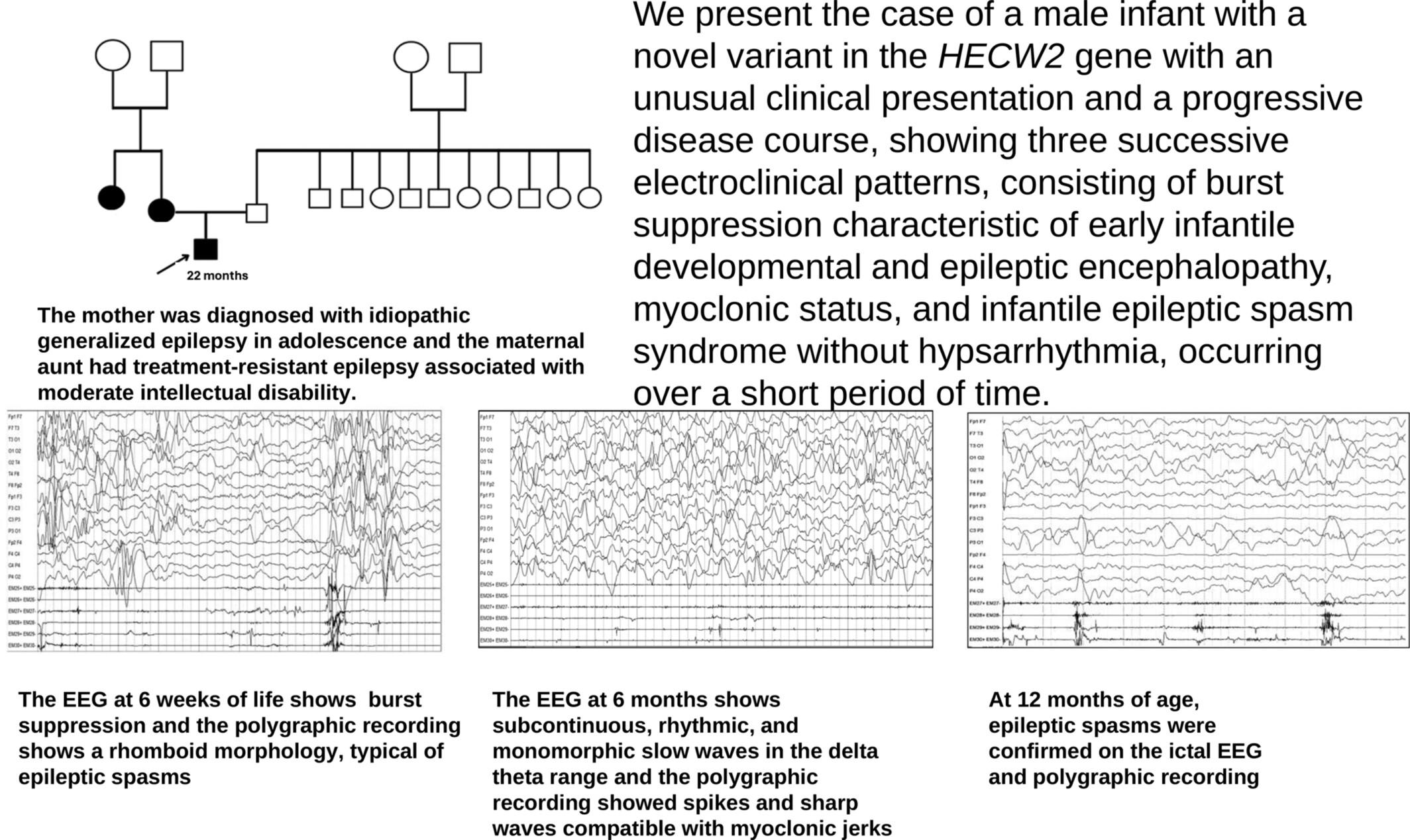 Rapid Electroclinical Evolution in HECW2-Related Developmental and Epileptic Encephalopathy: Report of a Likely Splicing Variant With Familial Transmission
