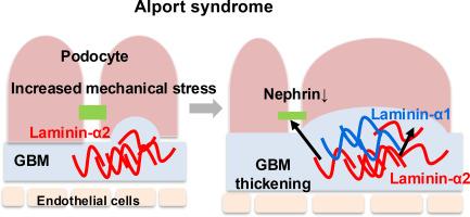 Ectopic laminin α2 accumulation in the glomerular basement membrane exacerbates podocyte injury in Alport syndrome