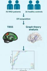 Altered white matter integrity and structural network topology in rhegmatogenous retinal detachment: A diffusion tensor imaging study