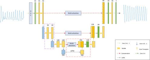 Heart rate estimation for U-Net and LSTM models combining multiple attention mechanisms
