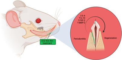 Oral thin film containing rice husk liquid smoke effects on the expression of key cytokines and growth factors in a periodontitis model