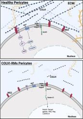 Defective collagen VI-NG2 axis impairs pericyte balance between proliferation and quiescence in COLVI-related myopathies