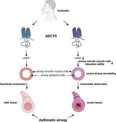 An Ile to Met polymorphism in ADCY9 promotes airway obstruction and remodeling in asthma