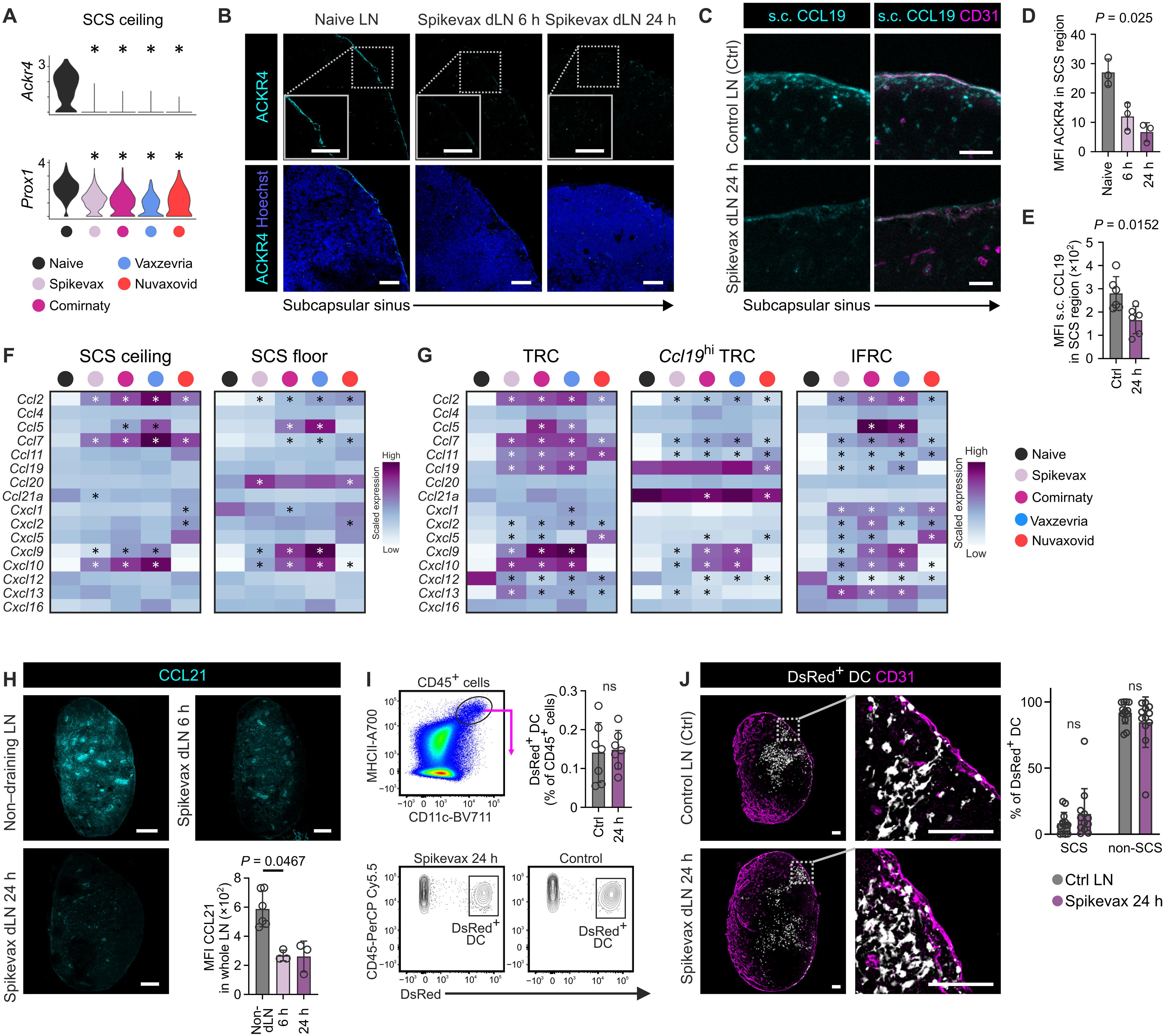 COVID-19 vaccine type controls stromal reprogramming in draining lymph nodes