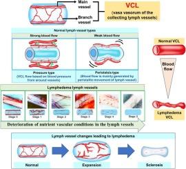 Comparative analysis of superficial collecting lymph vessels in normal tissue and lymphedema using video-capillaroscopy