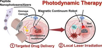 Magnetic continuum robot-mediated intracranial delivery of peptide nanophotosensitizers for glioblastoma photodynamic therapy