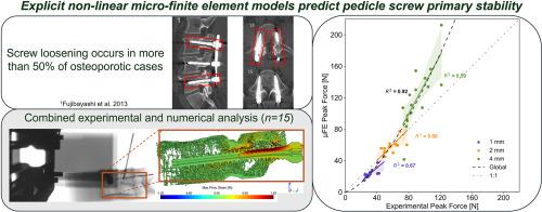 Experimental and micro-finite element analysis of the toggling behaviour of a carbon fibre-reinforced PEEK pedicle screw