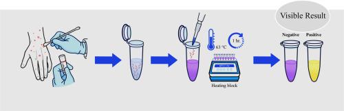 Validation and application of a visual LAMP assay for Mpox diagnosis — Insights from clinical samples in Thailand