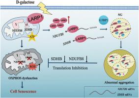 Targeting LARP1 to mitigate aging in lens epithelial cells: mechanistic insights into mitochondrial dysfunction