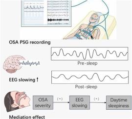 Post-sleep electroencephalographic slowing correlates with the severity of obstructive sleep apnea and daytime sleepiness