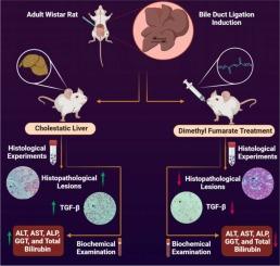 Evaluation of the effects of dimethyl fumarate on transforming growth factor beta levels in the liver of rats with bile duct ligation-induced cholestasis