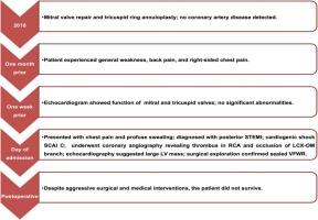 Contained ventricular free wall rupture without pericardial effusion: a diagnostic challenge in acute myocardial infarction