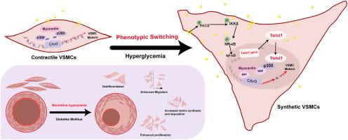 Twist1 promoting neointima hyperplasia after vascular injury in diabetes via regulating hyperglycemia-induced phenotype switching of vascular smooth muscle cells
