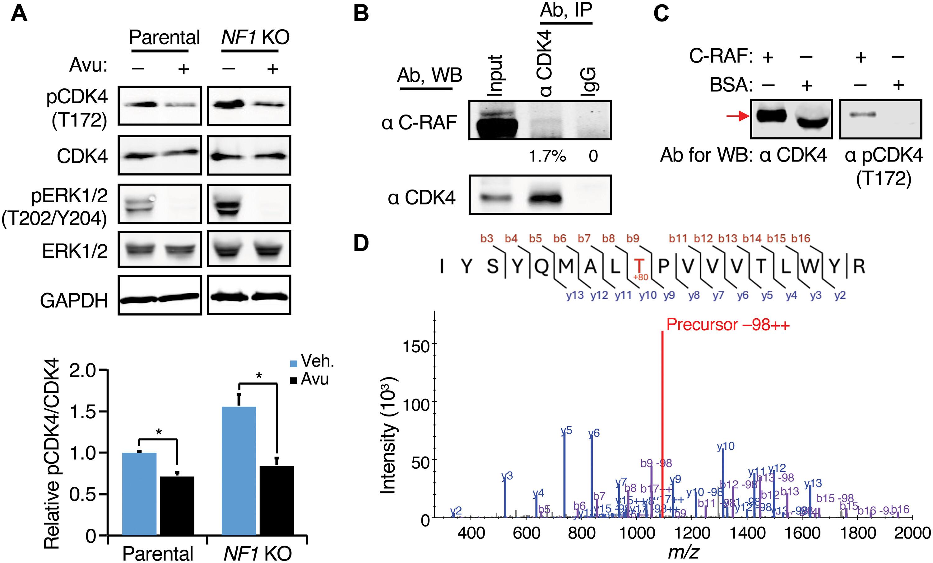 NF1-depleted ER+ breast cancers are differentially sensitive to CDK4/6 inhibitors