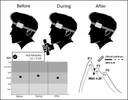 Test-retest reliability of non-invasive P2/P1 ratio and time to peak at rest and during isometric handgrip stress