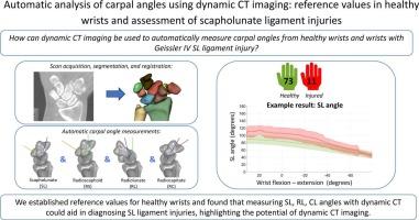 Automatic analysis of carpal angles using dynamic CT imaging: Reference values in healthy wrists and assessment of scapholunate ligament injuries