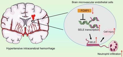 Selectin E upregulation upon forkhead box P1 loss augments neutrophil infiltration and brain damage in hypertensive intracerebral hemorrhage