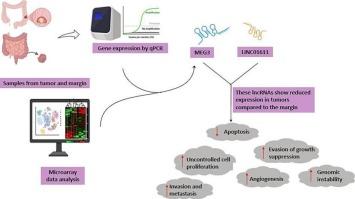 Altered expression patterns of lncRNA MEG3 and LINC01611 in patients with colorectal cancer