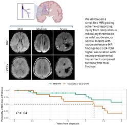 Radiographic Severity of Neonatal Deep Medullary Venous Thrombosis is Associated with Neurodevelopmental Impairment