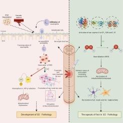 Nano-shields: Exploring the role of antioxidant mimicking nanoparticles as regenerative therapy in spinal cord injury