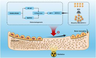 NFATc1-targeted siRNA microdroplets prevent radiation-induced osteoporosis by coordinating bone-immune crosstalk