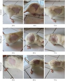 Cilnidipine-Loaded Niosomes: A Novel Transdermal Delivery System for Enhanced Permeation