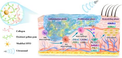 Ultrasound-activated piezoelectric hydrogel scaffold for synergistic immunomodulation and angiogenesis in accelerated wound healing