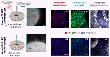 An immunocompetent bioengineered human dermal equivalent to recapitulate scar tissue formation in vitro