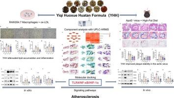 Protective effects of Yiqi Huoxue Huatan formula on atherosclerosis: An in vivo and in vitro study