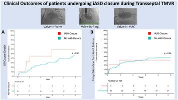 Outcomes of Iatrogenic Atrial Septal Defect Closure After Transseptal Transcatheter Mitral Valve Replacement in the Mitral Implantation of Transcatheter Valves (MITRAL) Trial