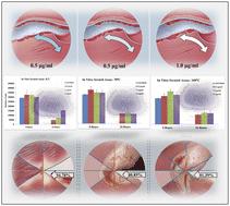 Semiconductor NbSe2 nanoparticles synthesized at various temperatures: a novel promising antifungal candidate with in vitro wound healing potential