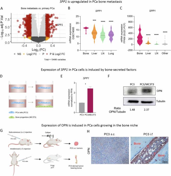 PKA-driven SPP1 activation as a novel mechanism connecting the bone microenvironment to prostate cancer progression