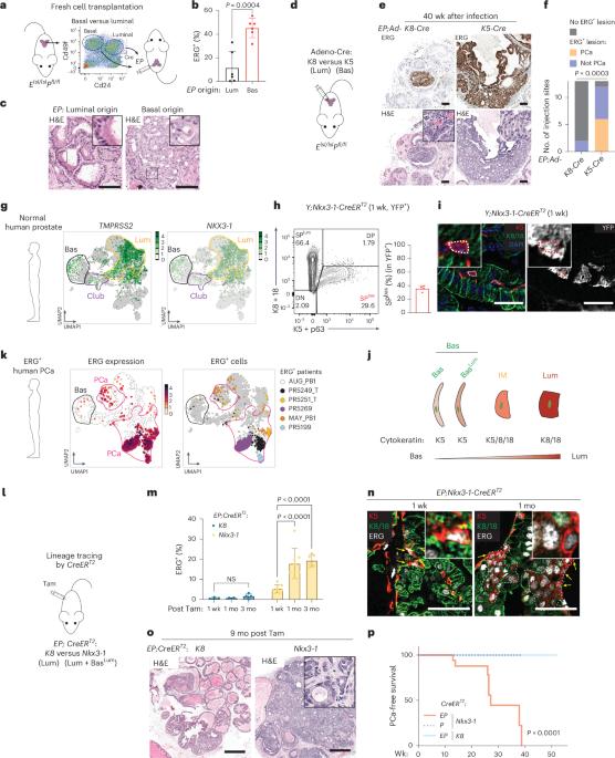 ERG-driven prostate cancer initiation is cell-context dependent and requires KMT2A and DOT1L