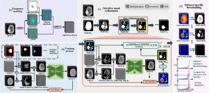 IterMask3D: Unsupervised anomaly detection and segmentation with test-time iterative mask refinement in 3D brain MRI